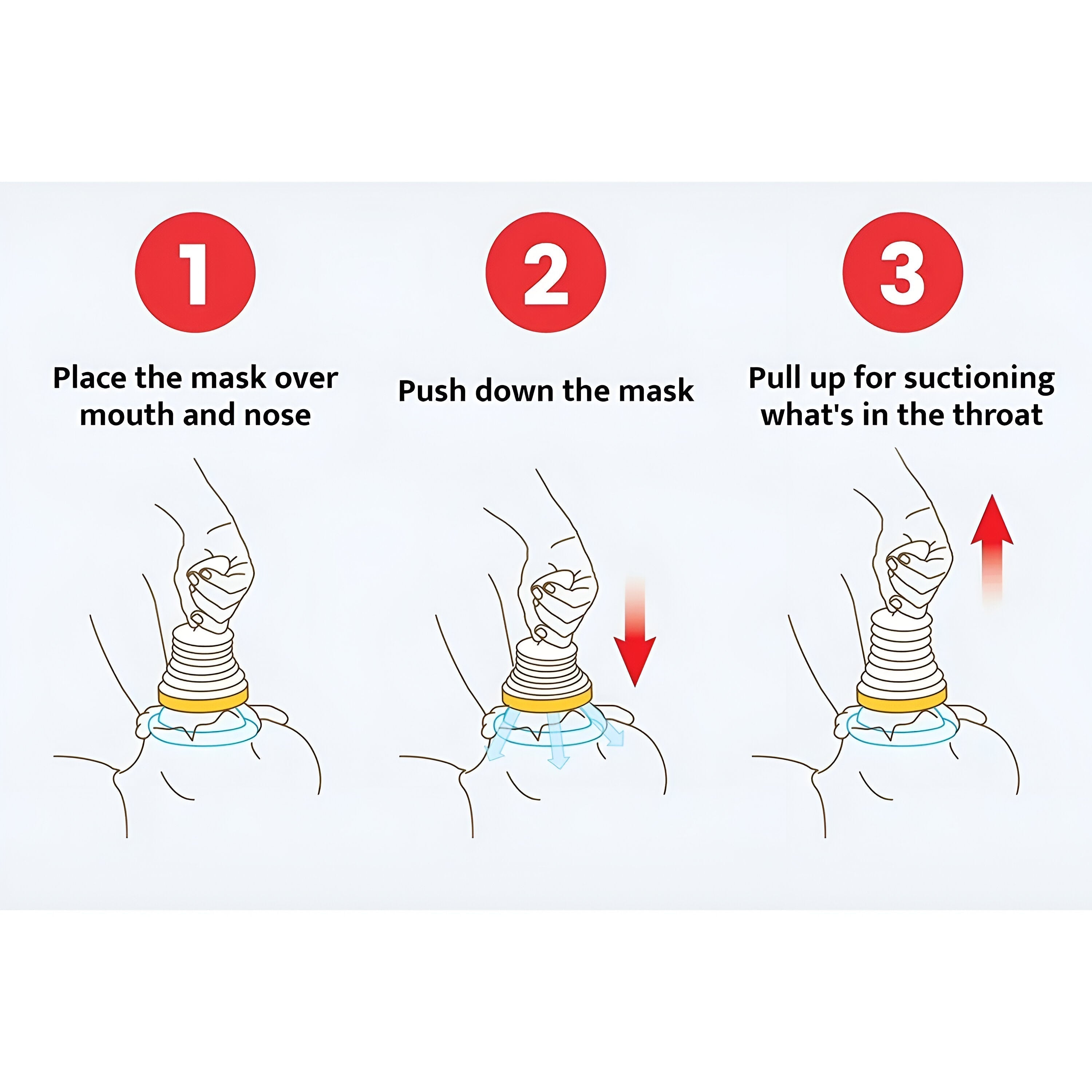 ANFINITE AirwayUnblocker Strumento di Emergenza per Ostruzione delle Vie Aeree